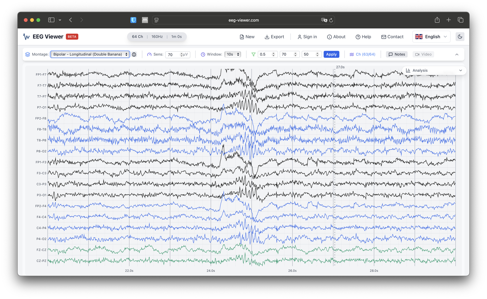 Screenshot of EEG Viewer with an example EEG loaded in the browser