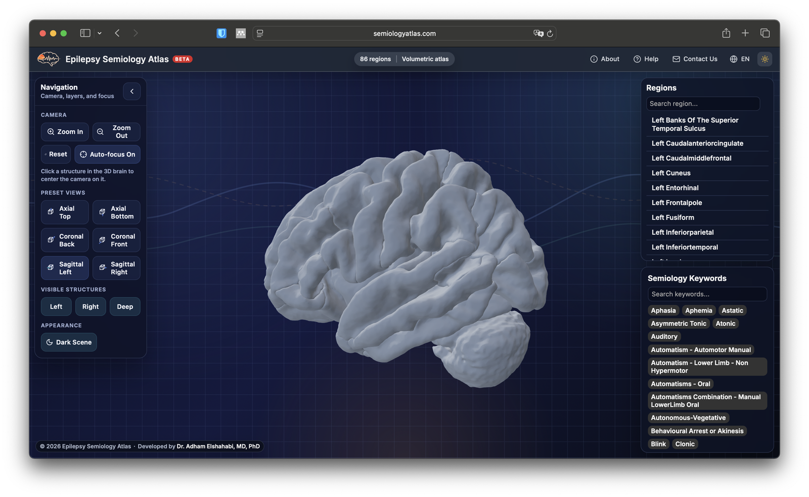 Screenshot of Semiology Atlas showing the interactive brain interface